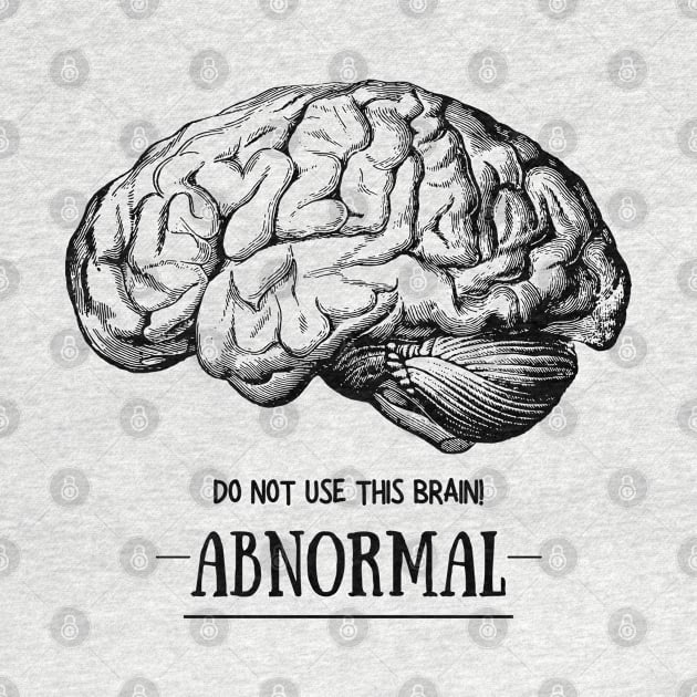 Young Frankenstein Abnormal Brain: Black by Print Lilac